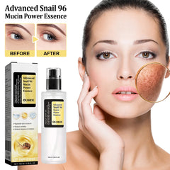 OUHOE Advanced Skincare Anti Aging 96% Snail Mucus Skin Care Essence Solution Facial Whitening Repair Serum For Sensitive Skin