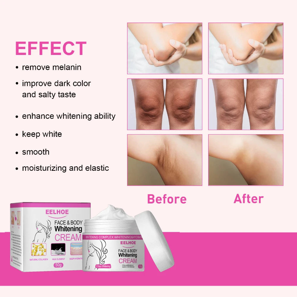 Body Whitening Cream Private Parts Underarm Bleaching Serum Remove Melanin Pigmentation Brighten Inner Thigh Intimate Dark