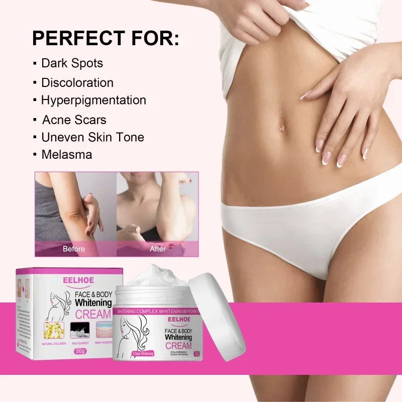 Body Whitening Cream Private Parts Underarm Bleaching Serum Remove Melanin Pigmentation Brighten Inner Thigh Intimate Dark