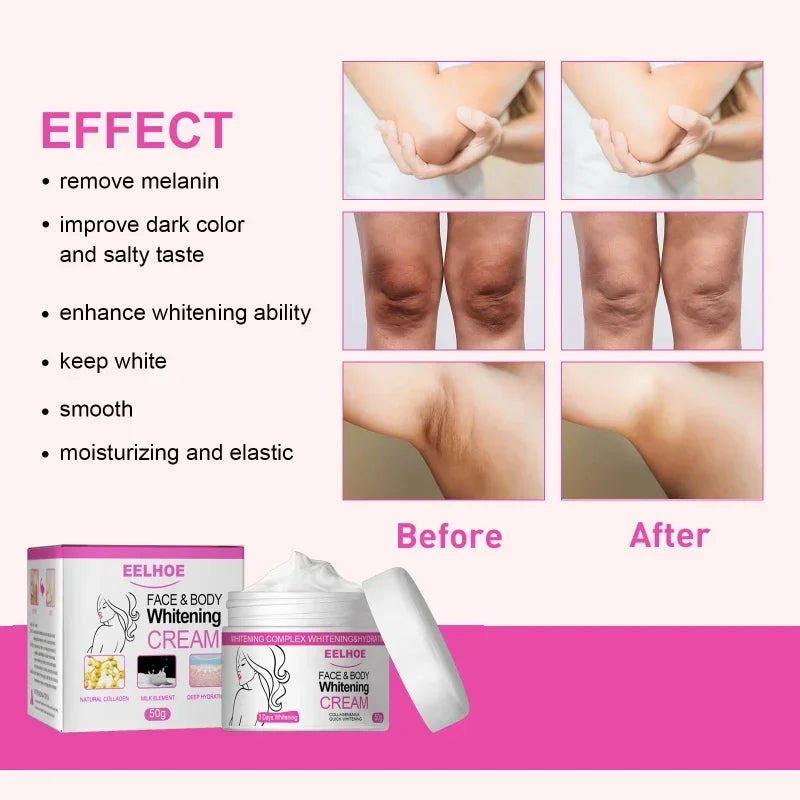 Body Whitening Cream Private Parts Underarm Bleaching Serum Remove Melanin Pigmentation Brighten Inner Thigh Intimate Dark